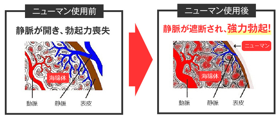 なぜ硬くなる？
