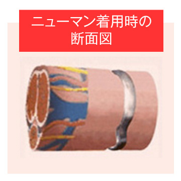 なぜ早漏改善できる？